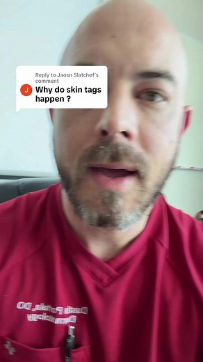 Why Do Skin Tags Keep Appearing? Real Causes Revealed