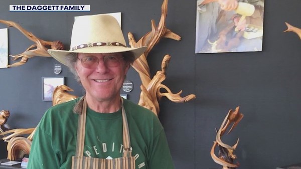 Deep brain stimulation eases Arizona man's Parkinson's