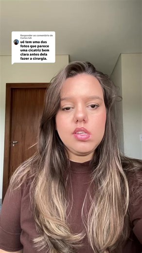 Paralisia Facial: Minha História e Reflexões