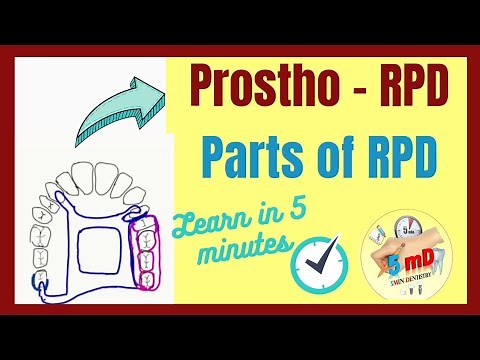 RPD | PARTS OF REMOVABLE PARTIAL DENTURE | Prosthodontics