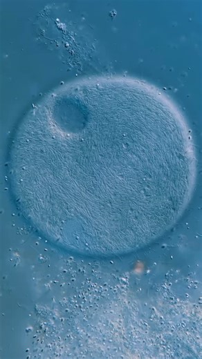 Jam's Germs on Instagram: "This is one of the new species I discovered. Although I published it in a peer-reviewed journal in 2024, I haven’t named it yet. This species has a unique characteristic; every individual has thousands of single-celled prokaryotes living inside its cell, like our gut microbiome. You can see the prokaryotes as tiny rods inside. . In the first clip, the organism is in its “dormant” state, with all the prokaryotes being moved around by the cell to distribute nutrients and