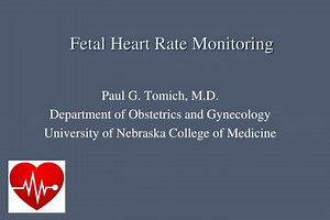 Fetal Heart Rate Monitoring - SlideServe