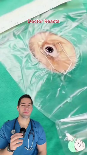 Whats going on here? #doctor #eye #opthalmology #operatingroom #nurses | rapid eye movement