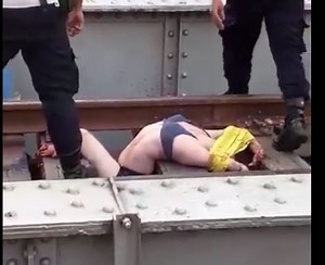 Gore video - The woman who had her arms and legs amputated by the train - XGore - Extreme Gore Videos