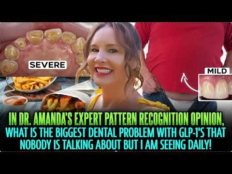 Orthodontic Invisalign Problems and Damage with GLP-1's? Dr Amanda's EVIDENCE BASED Hypothesis