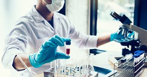 Badanie CA 125 - wskazania, interpretacja wyników, cena. Na czym polega badanie i jakie są normy?