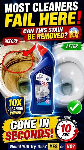How to Remove Yellow Toilet Ring Stains Fast 🚽 | Bluemoon Toilet Cleaner Before & After