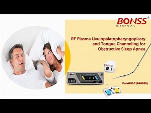 RF Plasma Uvulopalatopharyngoplasty and Tongue Channeling for Obstructive Sleep Apnea