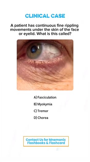 𝑴𝒆𝒅 𝑸𝒖𝒊𝒛𝒛𝒊𝒏𝒈 on Instagram: "Comment “Details” and check your inbox for the full mnemonic flashbook & flashcards! 📕✨ . . . . . . #medical #medicine #medicalstudent #medicinestudent #usmle #step1 #plab #mrcp #medicine #reels #viral #foryou #anatomy #reelexplore #instagram #neurology #nephrology #surgery #students #colleges #cardiology #knowledge #virals #plab #UK #USA #newyork #nyc #neet"