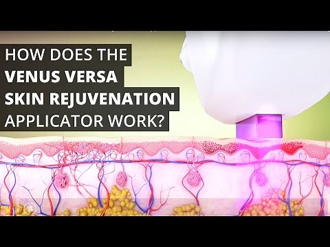 How Does the Venus Versa™ Skin Rejuvenation Applicator Work?