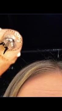 USDA: First case of New World screwworm confirmed in South Texas calf