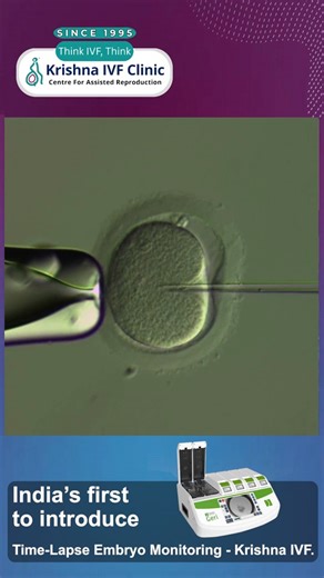 ICSI in Simple Words: How It Helps Fertilization & Supports Couples...