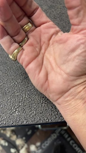 Hand Cramps: Causes, Remedies, and Prevention