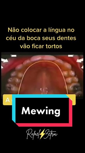 Mewing.BR no TikTok