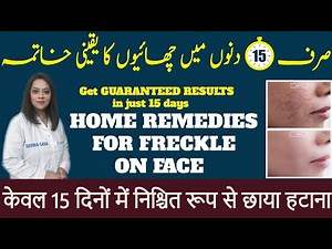 Get GUARANTEED RESULTS in just 15 days| home remedies for freckle on face|dr batool ashraf official