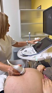 Voluson Expert 22 – ултразвучна прецизност со вештачка интелигенција за максимална точност во дијагностиката. Во Болница Плодност веруваме дека најновите технологии и трендови во медицината, потпомогнати од знаењето и искуството на нашите експерти, се клучни за прецизна и сигурна дијагностика. Voluson Expert 22 е повеќе од ултразвучен апарат, со напредната AI технологија што ја користи за автоматизирани мерења и аналитички алгоритми, овозможува побрзо детектирање на анатомски структури, пократки