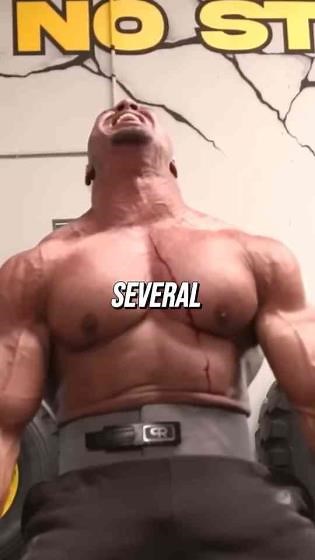 Why Bodybuilders Have Horrible Acne?