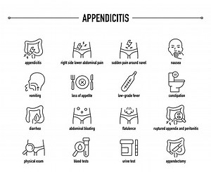 Appendizitis-Vektor-Icon-Set. Bearbeitbare medizinische Symbole.