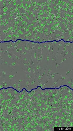 Scratch Wound Migration and Invasion Assays for Incucyte® Live-Cell Imaging & Analysis