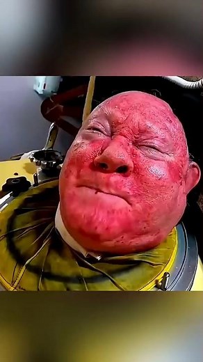 Curiosity number41 AMachine Once Thought to Be Torture But It Saved Lives The Story of the Iron Lung