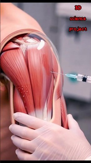 how to give an injection tutorial | Injection Administration Basics | Medical Student Tutorial