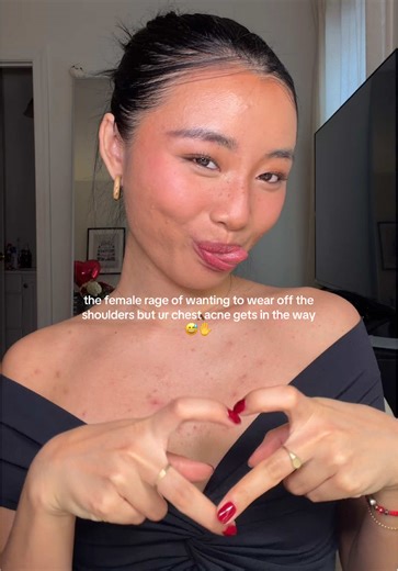 Understanding and Managing Chest Pimples