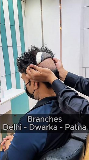 How to Apply Hair Patch with Glue Method 😱 Easy Guide #hairpatch #hairfixing