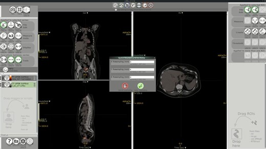 LIFEx教程1.3-对图像系列进行重新采样
