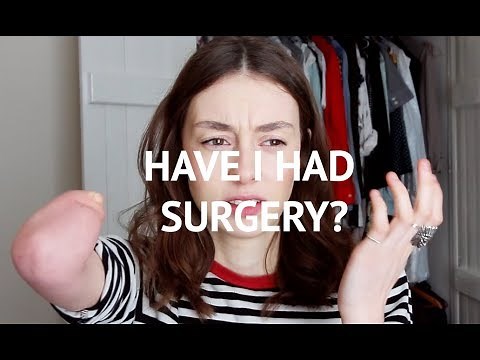 Answering Your Disability Questions