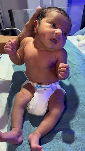 Newborn Reflexes Check 👶💙 | Baby During Routine Examination After Birth #god #facts #baby #cute #btsarmy #fbyシvideo #nicucare #baby #cutebaby #facts #viralvideochallenge This video captures a newborn baby during reflexes check, an important part of the post-birth examination. 👶💙 Reflex tests help doctors ensure the baby’s nervous system and muscle responses are working well. These checks include reflexes like grasping, sucking, rooting, and stepping, which are natural signs of a healthy newb