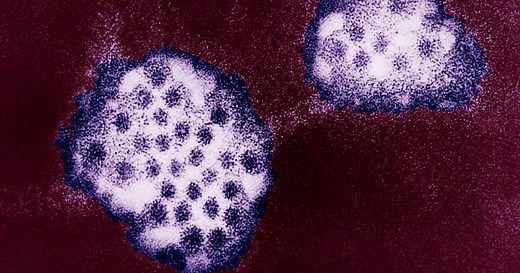 GI symptoms? It's probably not Covid, but it could be norovirus.