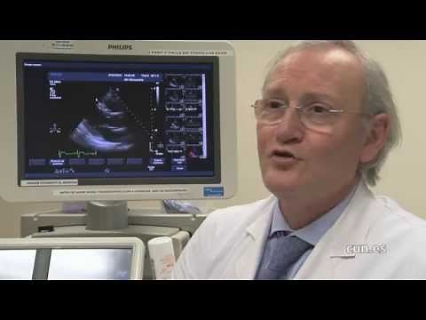 Los beneficios del deporte para el corazón (Clínica Universidad de Navarra)