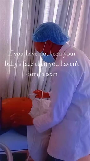 How 3D scan image appears#sonographer #motivation #linda #smallbusinessowner #insight