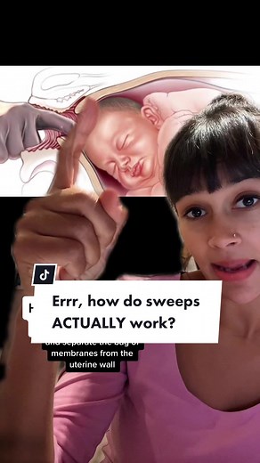 What happens when you have a sweep. Did you have one? Did it work? #membranesweep #membranesweepexperience #induction #inductionoflabour #inductionofpregnancy #pregnancy #pregnant #fyp #childbirtheducation #childbirtheducator #childbirtheducationclass #mother #motherhood #pregnancyjourney
