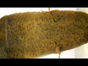 GENERAL PATHOLOGY 7 : amyloidosis ; pathological lesions , diagnosis DR SAMEH GHAZY