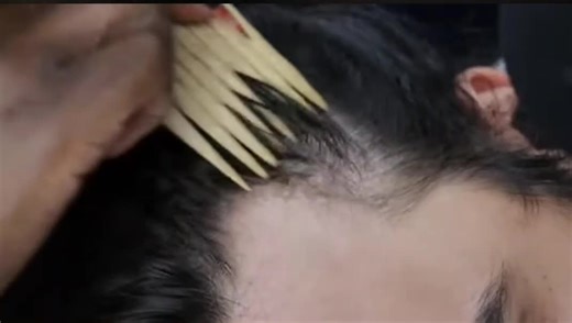 ASMR attentive nitpicking and soft whispering by The Asmr Couple(YT) #softwhispersasmr #scalpcareathome #asmrvideo #fyp