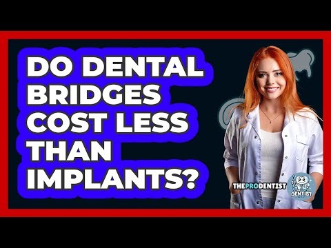 Do Dental Bridges Cost Less Than Implants?