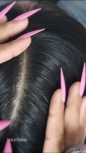 Layer by Layer | Peeling Thick Flakes Off the Scalp 🫧💅 #FlakyScalp #ASMRScalpCheck #DandruffCare #ScalpScratchASMR #RelaxingVideo #065 | Voice Flakes