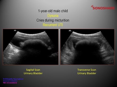 Image to Diagnosis –General Sonography – Urinary Tract 6