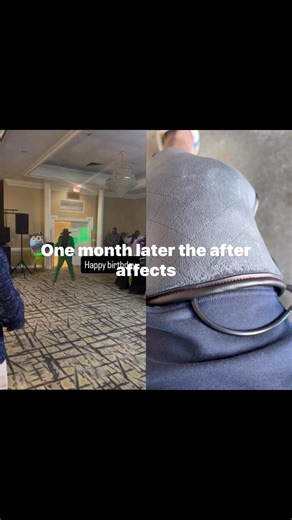 One month later the pain you pay for fame | Anthony Simpson