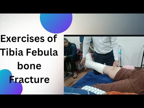 Exercise of Tibia Febula Bone Fracture #fracturerecovery #execiseathome