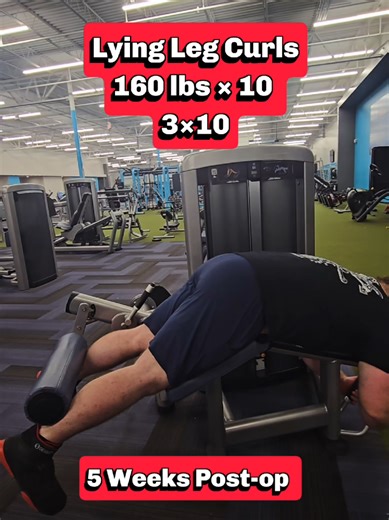 Week 20: Leg Day Exercise 2: Lying Leg Curls 5 Weeks Post-op 160 lbs × 10 3×10 #legday#exercise#workout
