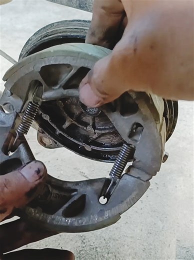 Essential Guide to Brake Shoe Replacement for DIY Mechanics