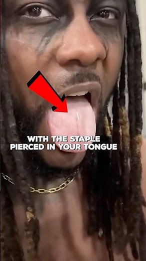 Swerve Strickland Got Stapled In His Tongue 😳