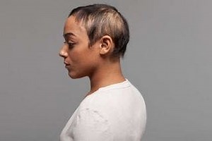 Have you noticed sudden hair loss?