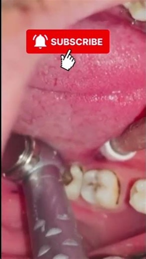 #dentistaslatinx #dentistry