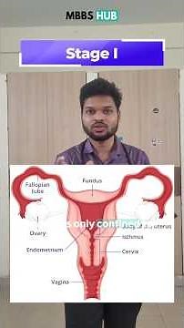 FIGO Staging for Cervical Cancer. Complete guide.