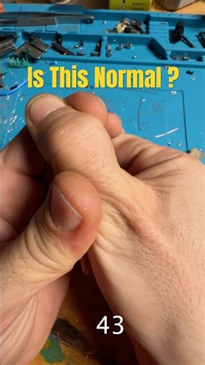 Is This Normal ! | Cracking Sound (ASMR) | Why Do Fingers Crack?