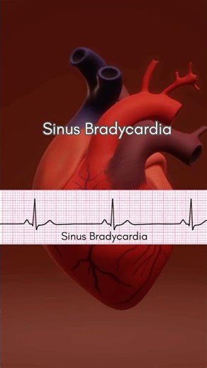 Sinus Bradycardia Verse | Name that Rhythm Song #nursingschool #nursingstudents #nclexprep