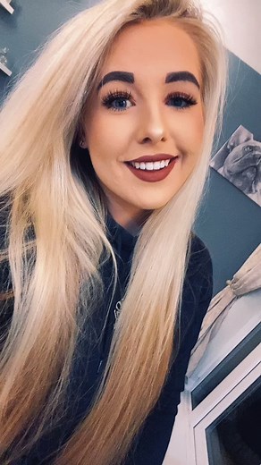 Empowering Dystonia Woman: Share Your Medical Condition!